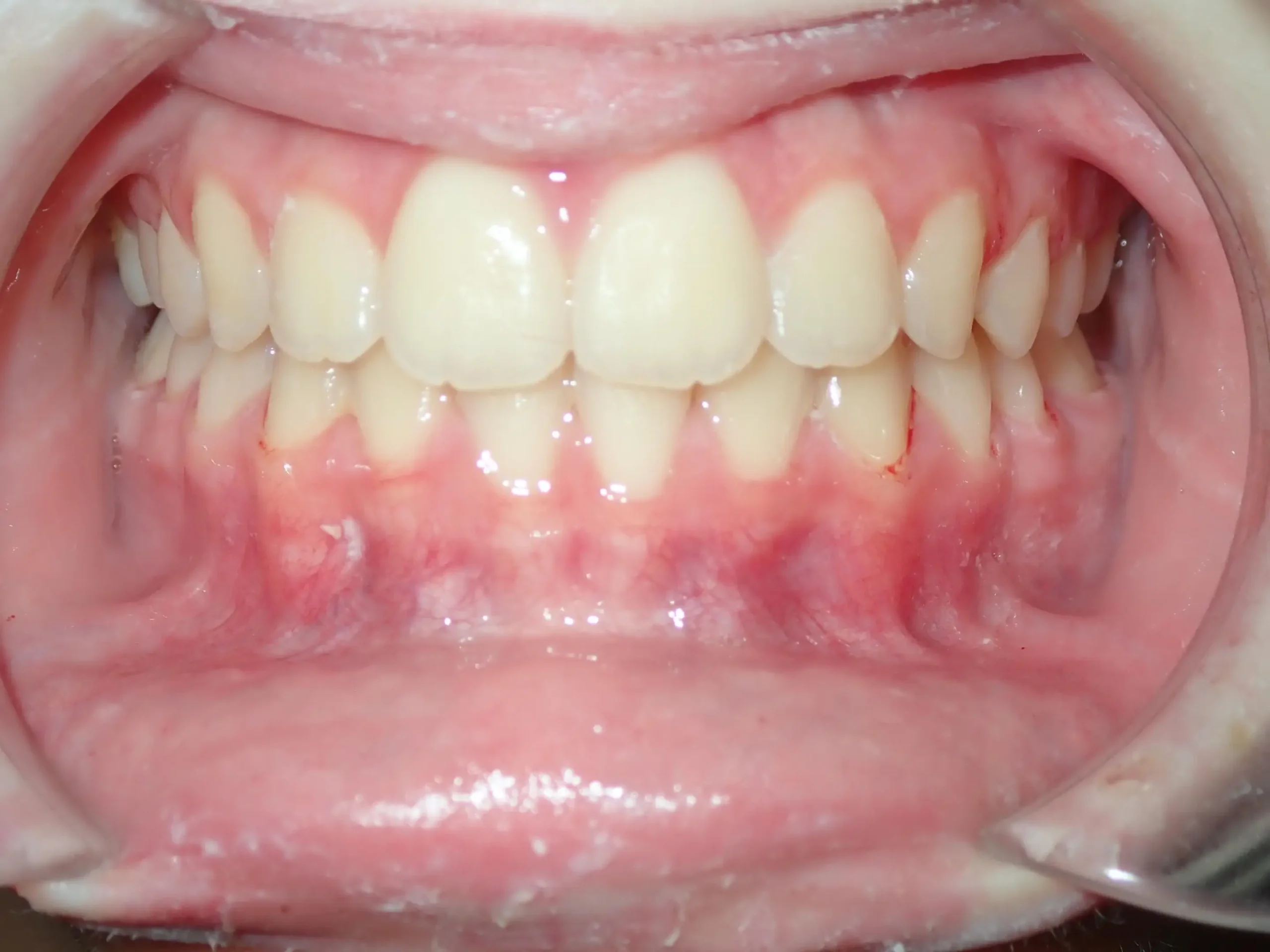 magnotta, samantha after