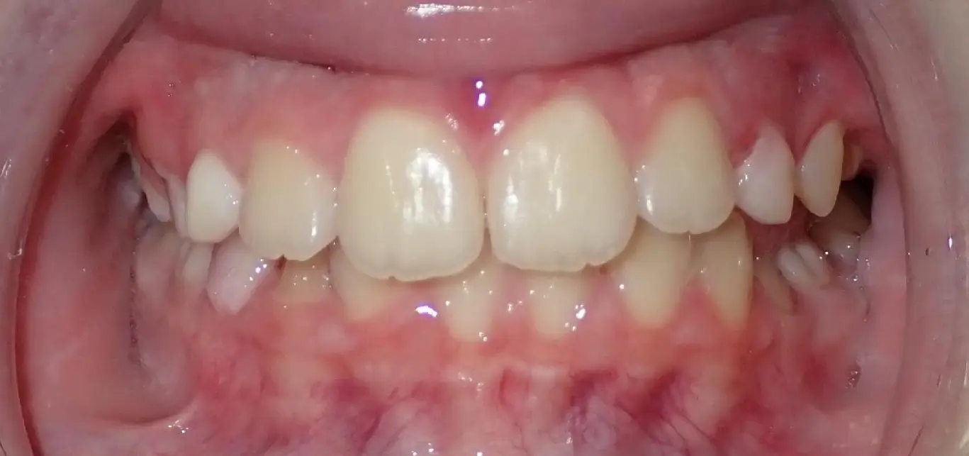 magnotta, samantha before