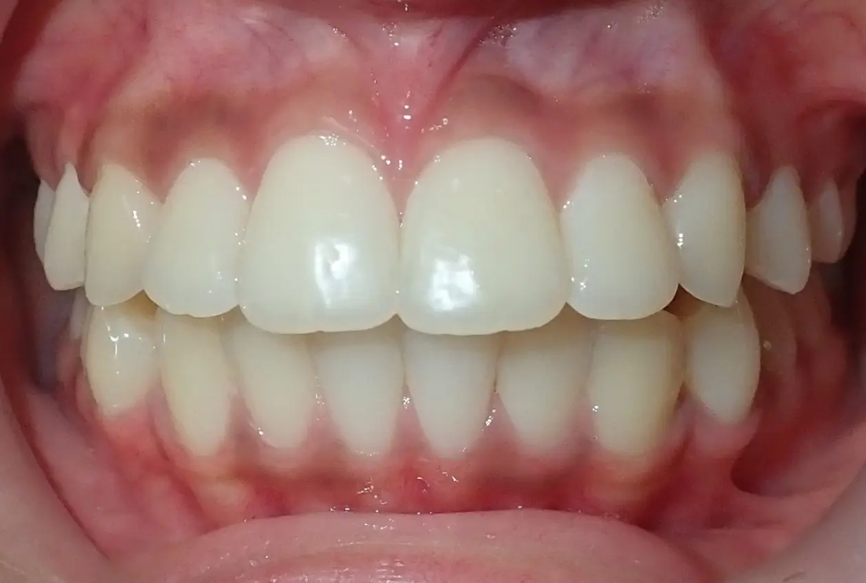 yosef, bethel before