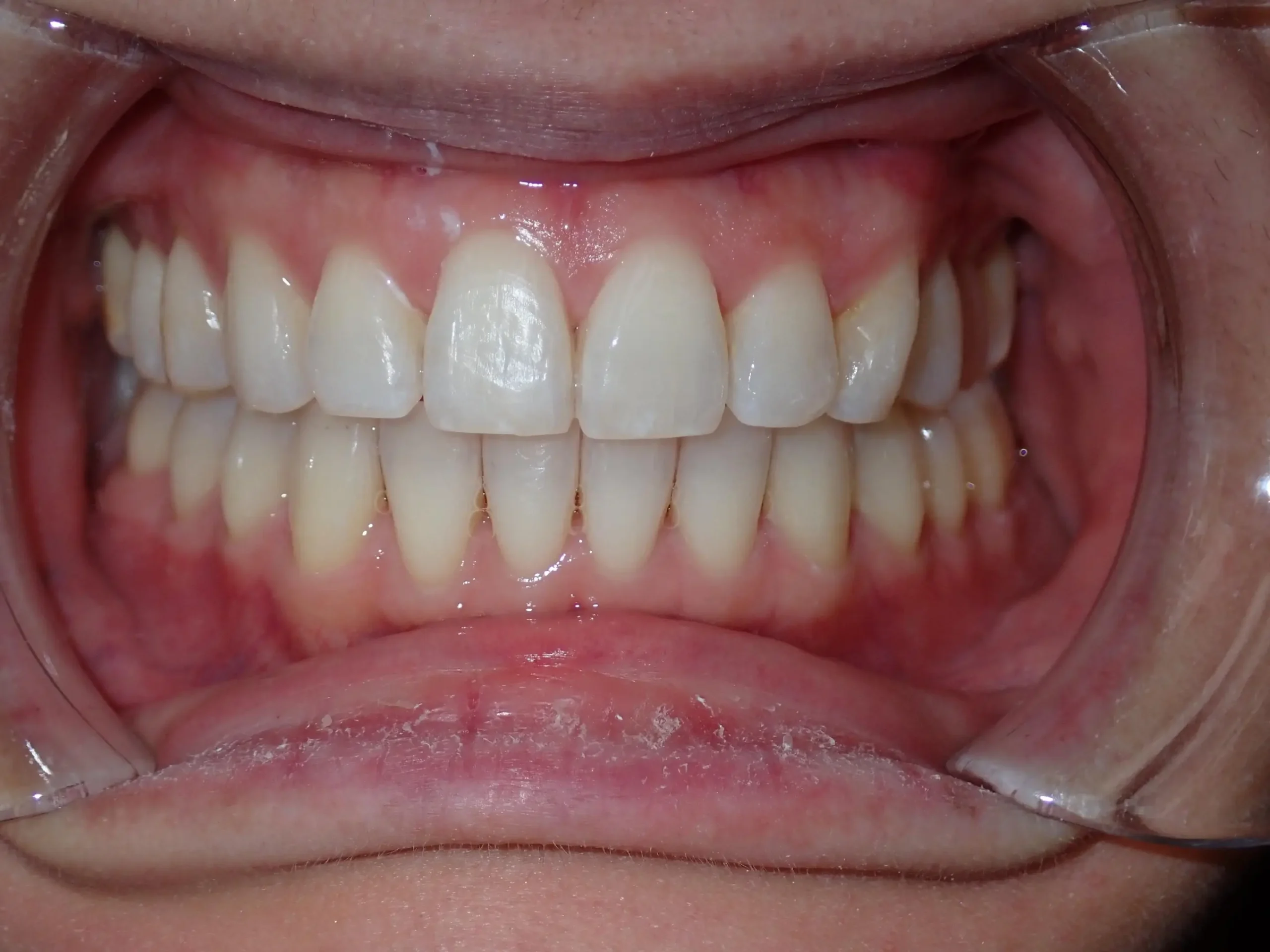 goldstein, lena after