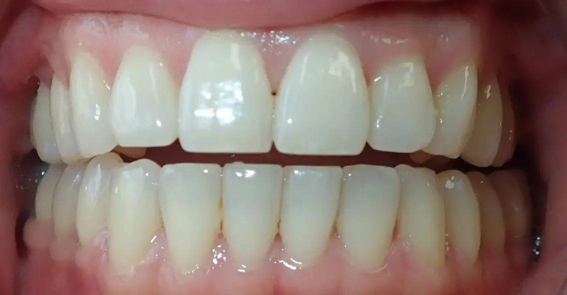 goldstein, lena before