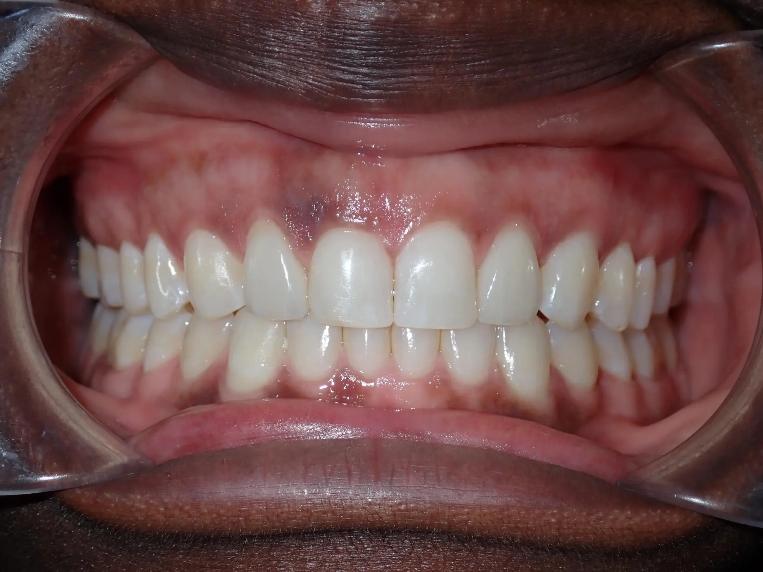 issoufou, barleh. after