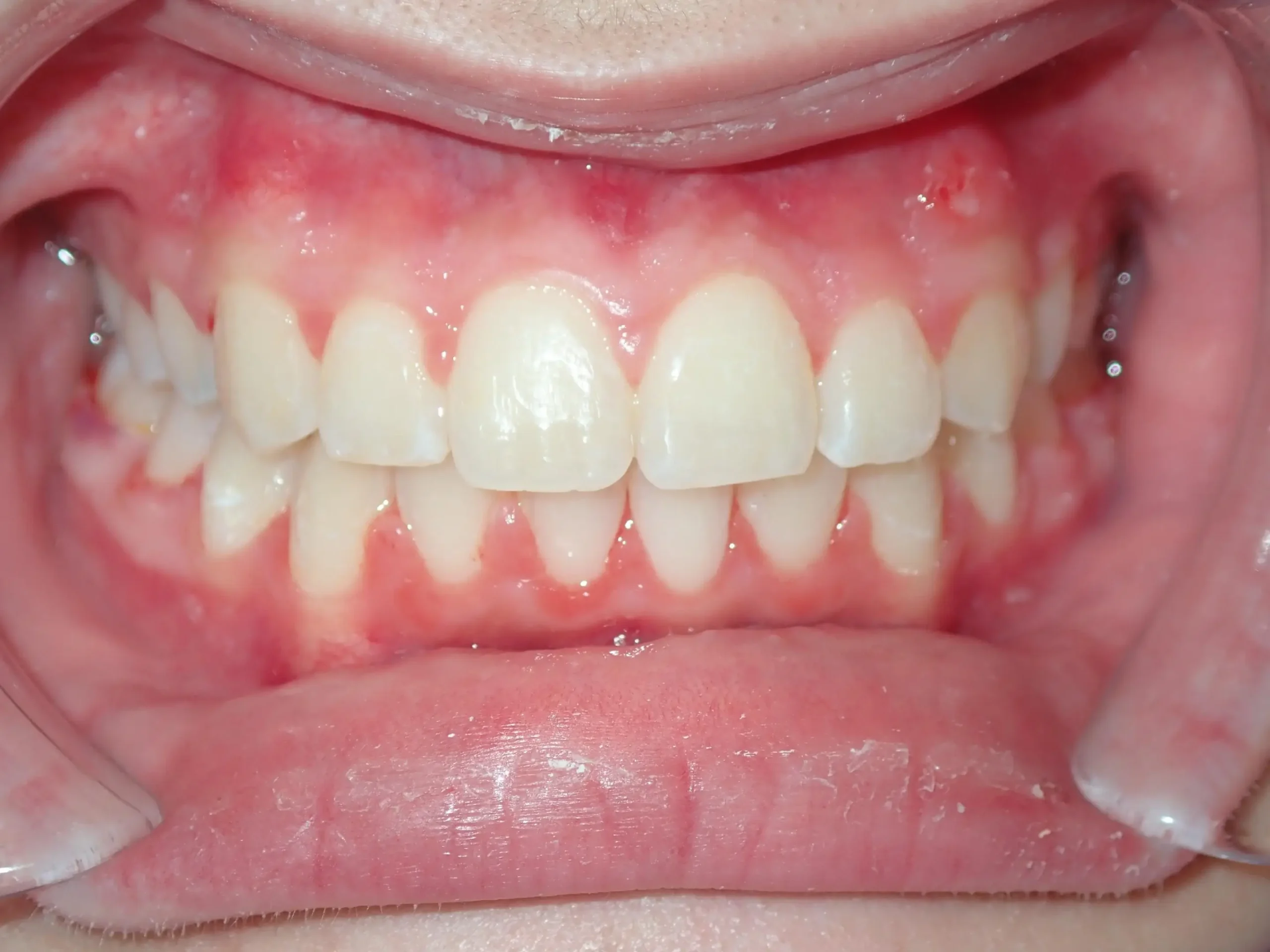 ortiz mejia, haley after