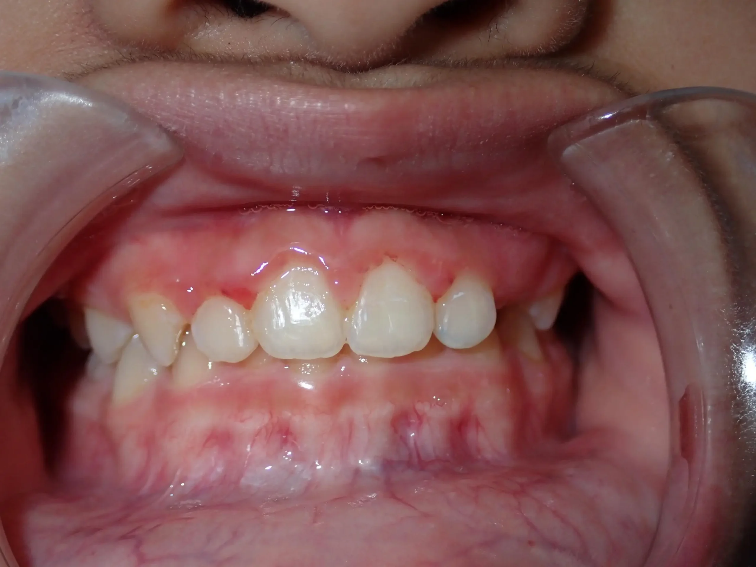 ventura, steven after