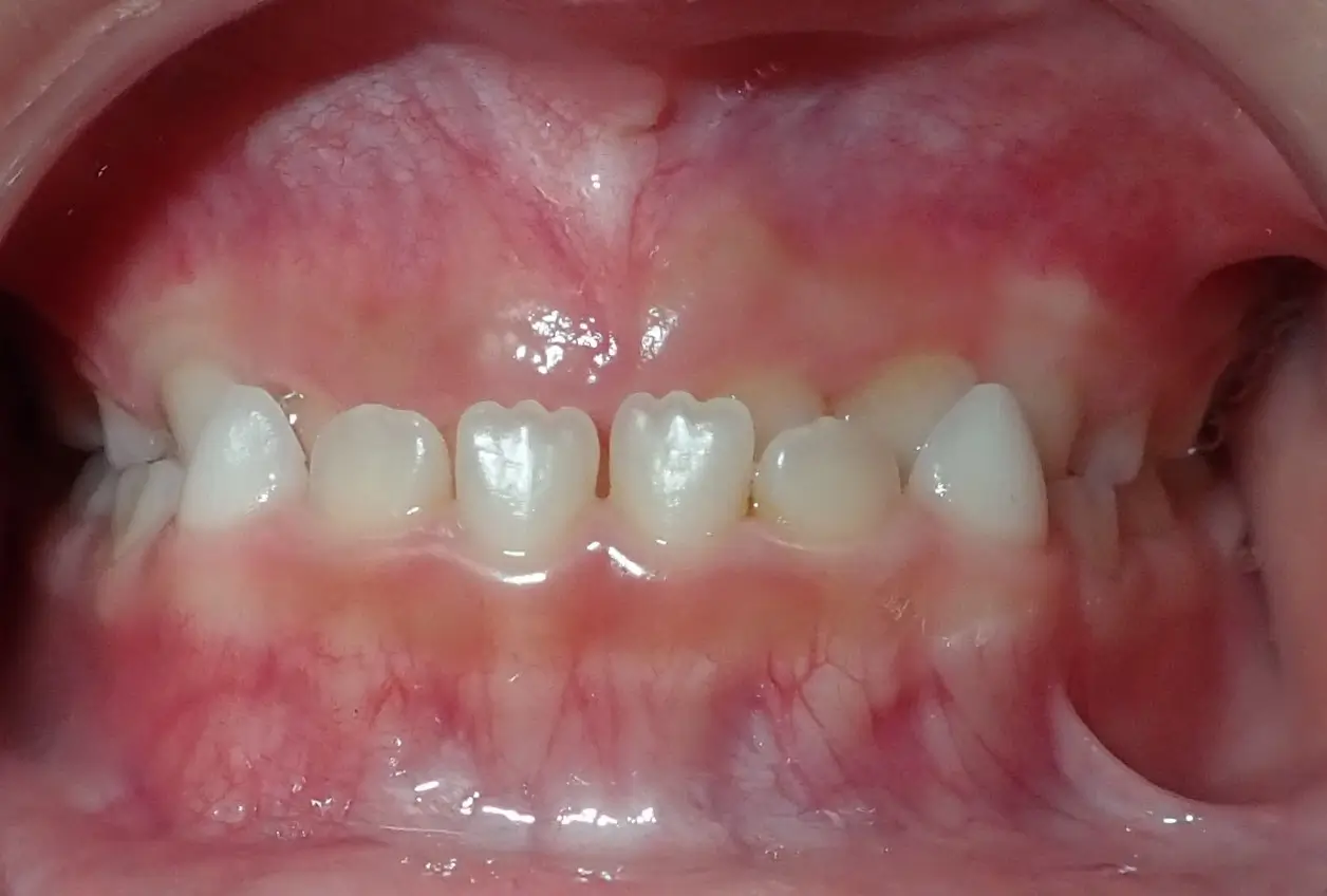 ventura, steven 20230308 before