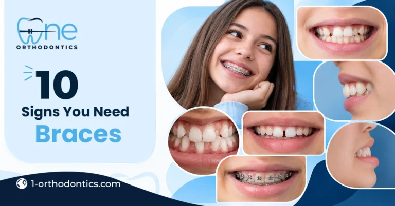 10 signs you may need braces, showing different orthodontic concerns