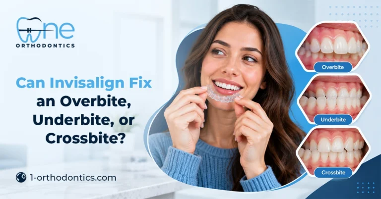 Invisalign aligners for correcting overbite, underbite, and crossbite conditions
